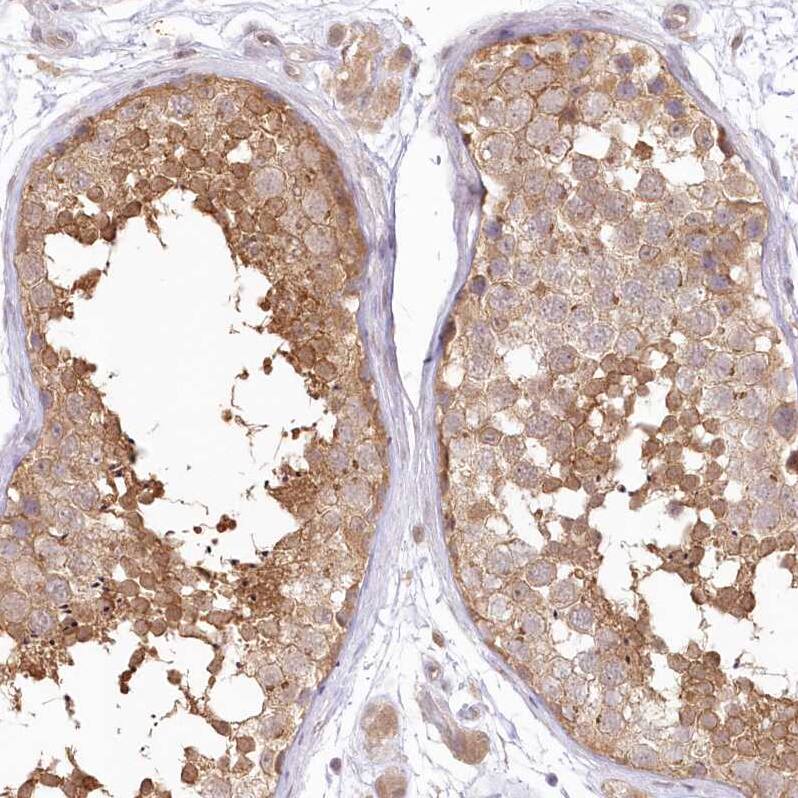 Aminopeptidase B/RNPEP Antibody - BSA Free Immunohistochemistry-Paraffin: Aminopeptidase B/RNPEP Antibody [NBP2-54975]