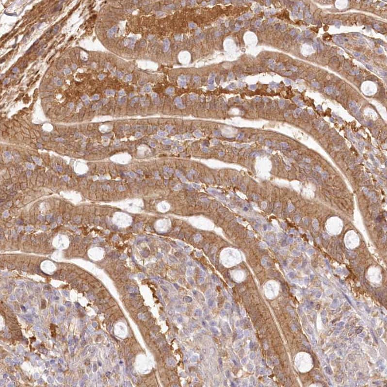 Aminopeptidase B/RNPEP Antibody - BSA Free Immunohistochemistry-Paraffin: Aminopeptidase B/RNPEP Antibody [NBP2-54975]