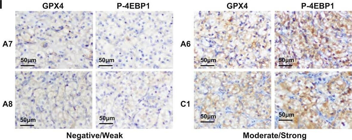 Glutathione Peroxidase 4/GPX4 Antibody