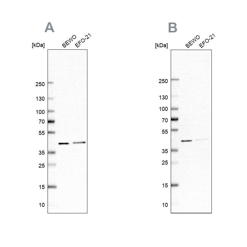 PCBP1 Antibody Western Blot: PCBP1 Antibody Antibody [NBP2-55063]