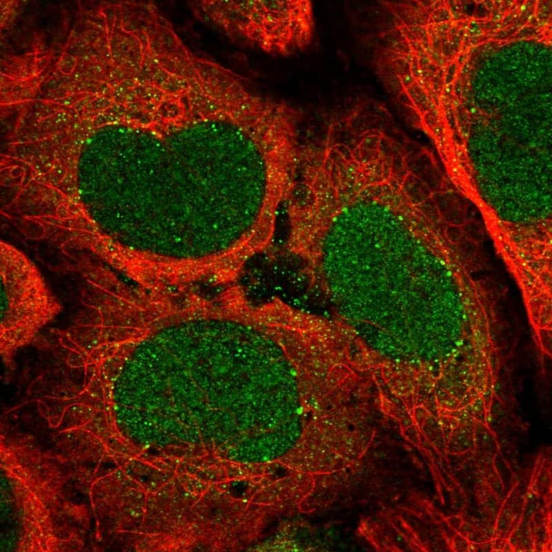ATP6V1A Antibody - BSA Free Immunocytochemistry/ Immunofluorescence: ATP6V1A Antibody [NBP2-55164]