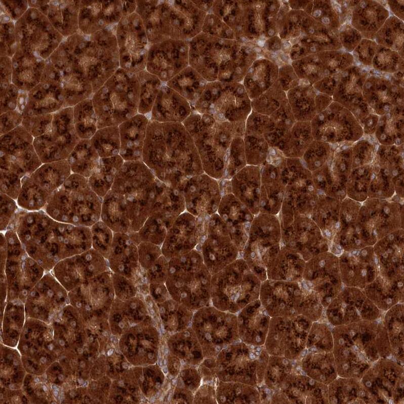 COPG Antibody - BSA Free Immunohistochemistry-Paraffin: COPG Antibody [NBP2-55178]