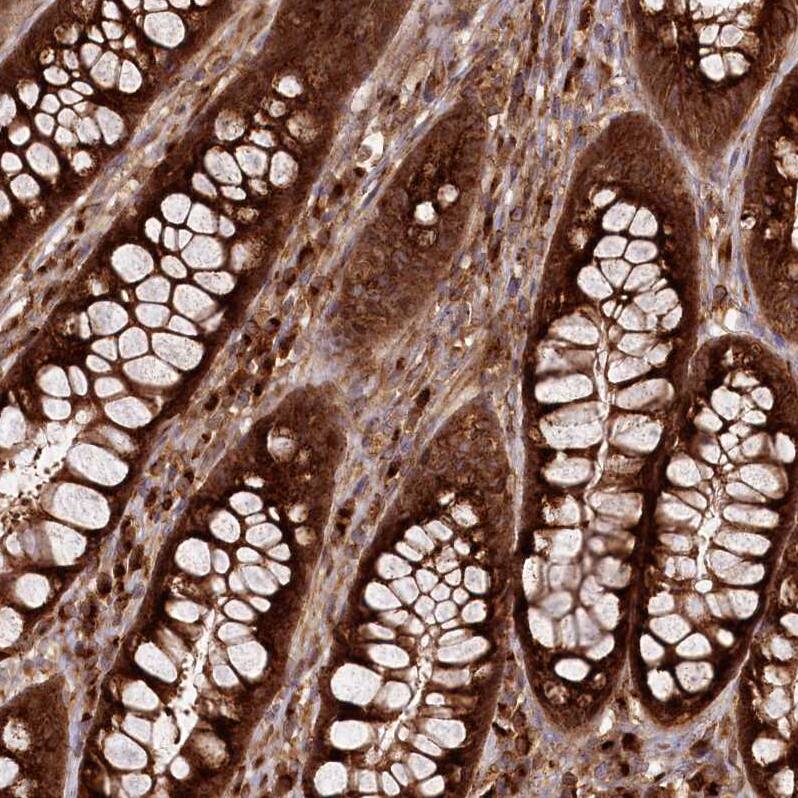 COPG Antibody - BSA Free Immunohistochemistry-Paraffin: COPG Antibody [NBP2-55178]