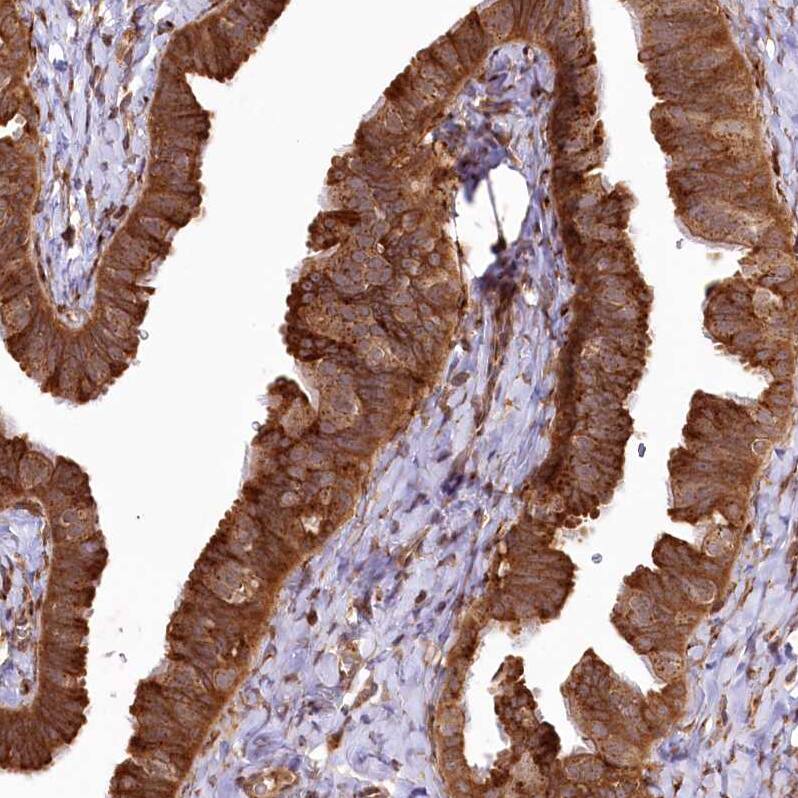 COPG Antibody - BSA Free Immunohistochemistry-Paraffin: COPG Antibody [NBP2-55178]