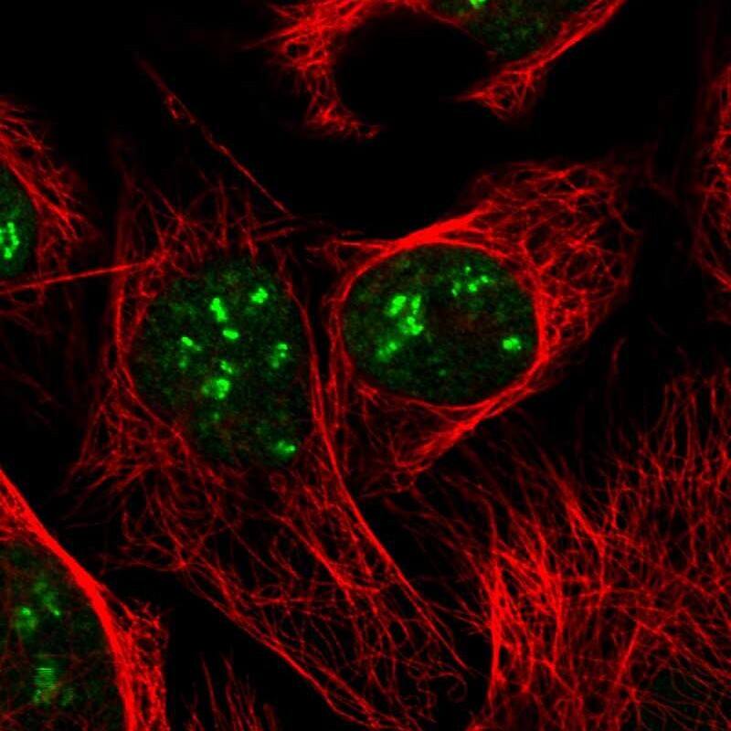 DKC1 Antibody - BSA Free Immunocytochemistry/ Immunofluorescence: DKC1 Antibody [NBP2-55221]