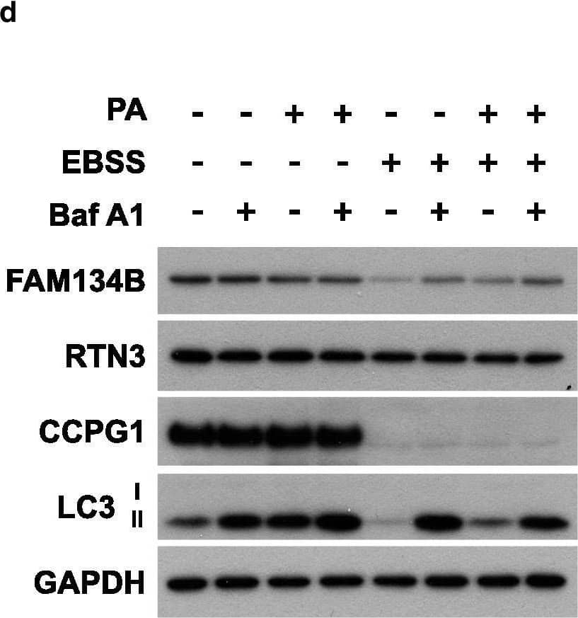 FAM134B Antibody