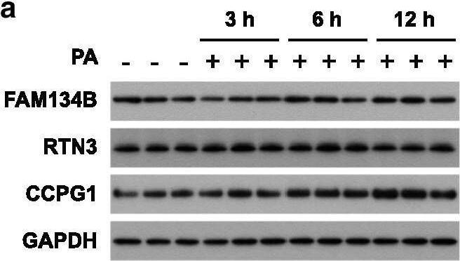 FAM134B Antibody