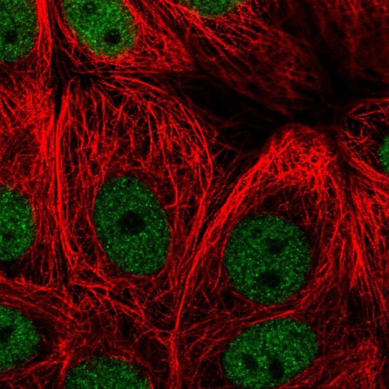 ZNF295 Antibody - BSA Free Immunocytochemistry/ Immunofluorescence: ZNF295 Antibody - BSA Free [NBP2-55455]