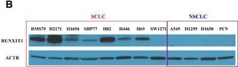 RUNX1T1/ETO Antibody - BSA Free