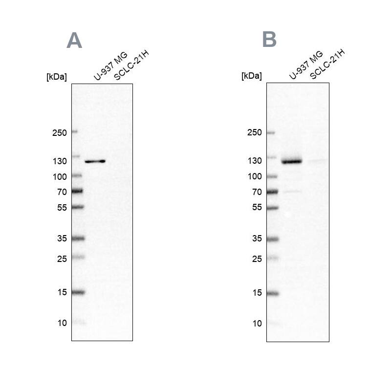 ARHGEF1 Antibody Western Blot: ARHGEF1 Antibody Antibody [NBP2-56320]