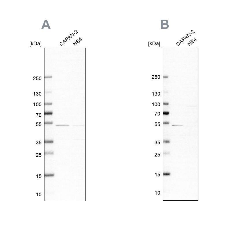 SPTLC1 Antibody Western Blot: SPTLC1 Antibody Antibody [NBP2-56477]
