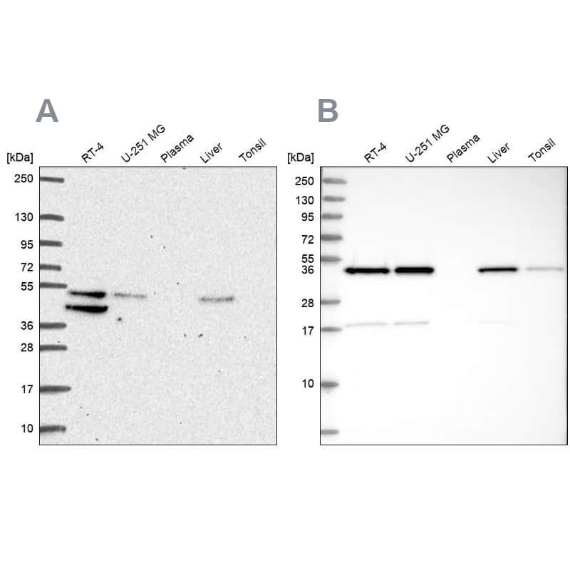 IKIP Antibody Western Blot: IKIP Antibody Antibody [NBP2-56525]