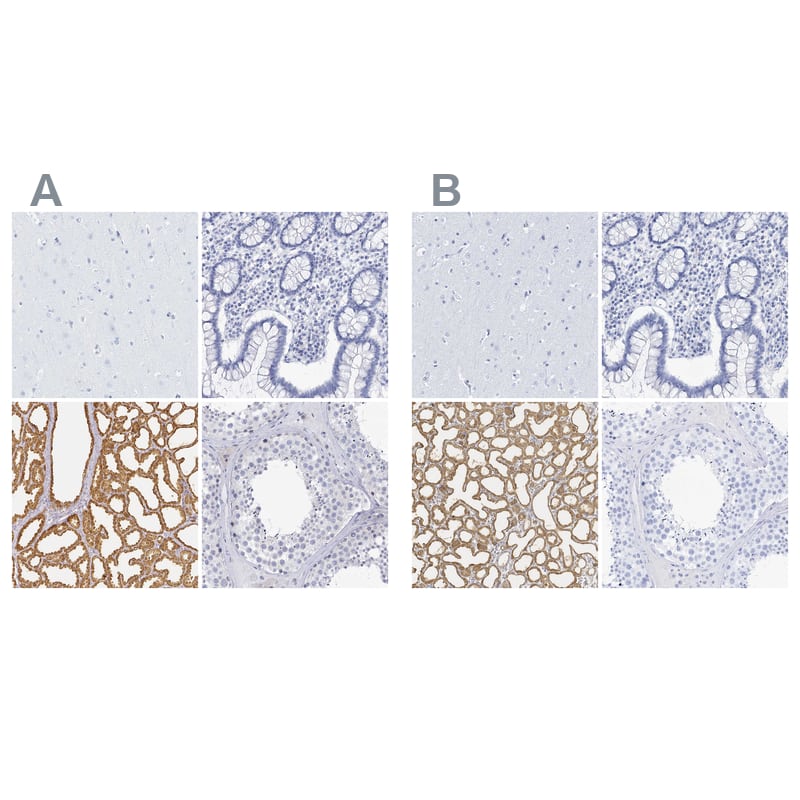 Lactalbumin Alpha Antibody Immunohistochemistry-Paraffin: Lactalbumin Alpha Antibody Antibody [NBP2-56836]