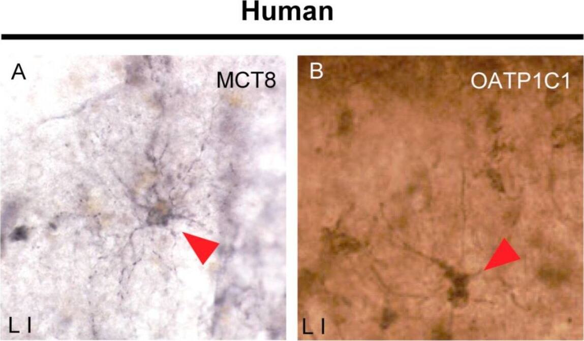 MCT8/SLC16A2 Antibody - BSA Free