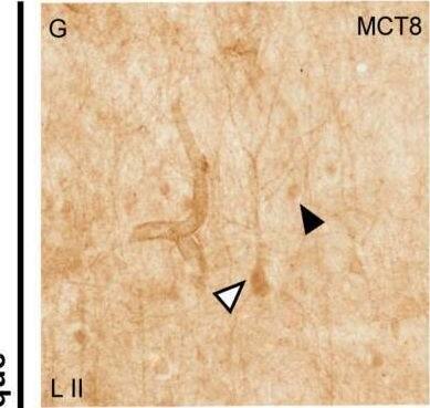 MCT8/SLC16A2 Antibody - BSA Free