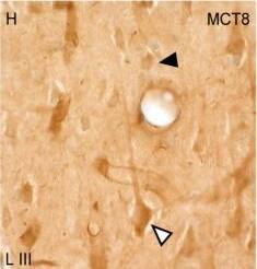 MCT8/SLC16A2 Antibody - BSA Free