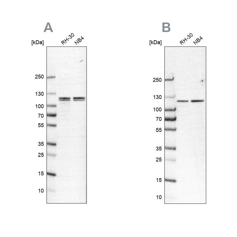 GPIP137 Antibody Western Blot: GPIP137 Antibody Antibody [NBP2-57388]