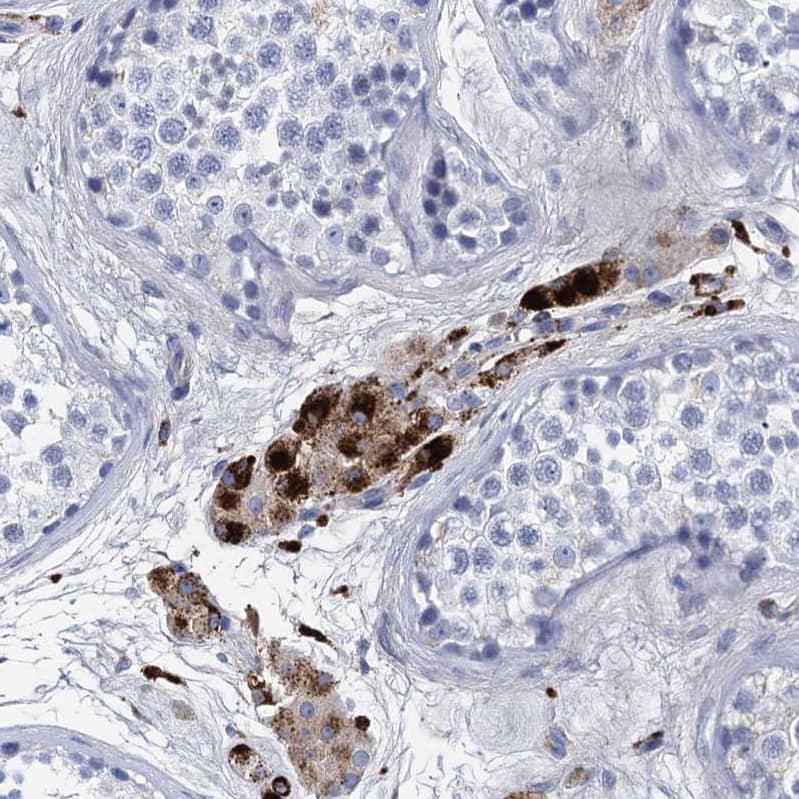 Apolipoprotein D Antibody - BSA Free Immunohistochemistry-Paraffin: Apolipoprotein D Antibody [NBP2-57684]