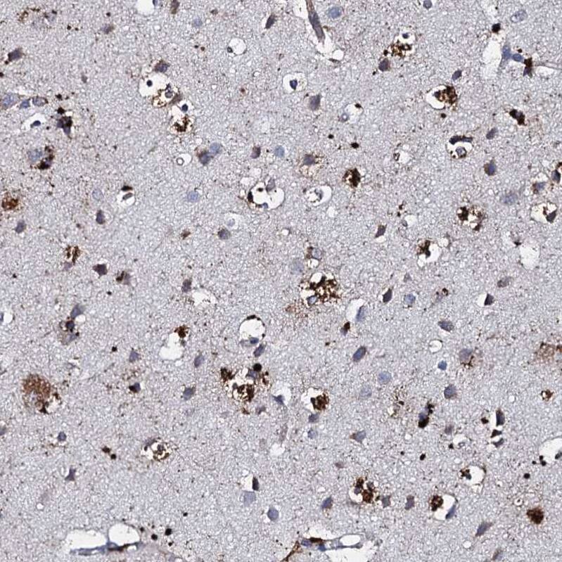 Apolipoprotein D Antibody - BSA Free Immunohistochemistry-Paraffin: Apolipoprotein D Antibody [NBP2-57684]