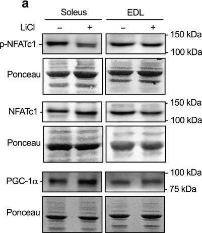 NFATC1/NFAT2 Antibody - BSA Free
