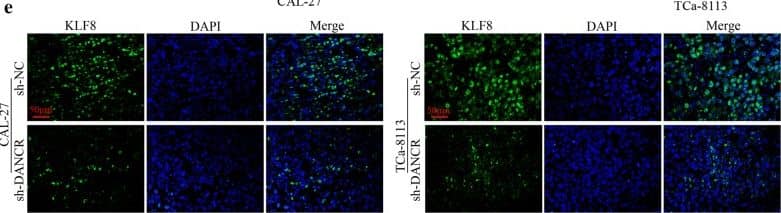 KLF8 Antibody - BSA Free