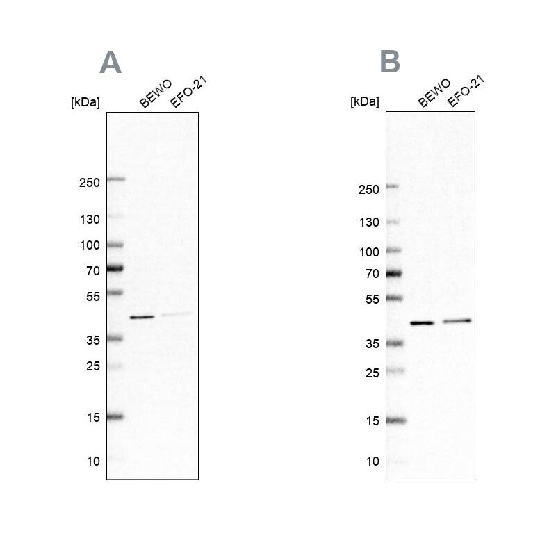 PCBP1 Antibody Western Blot: PCBP1 Antibody Antibody [NBP2-57878]