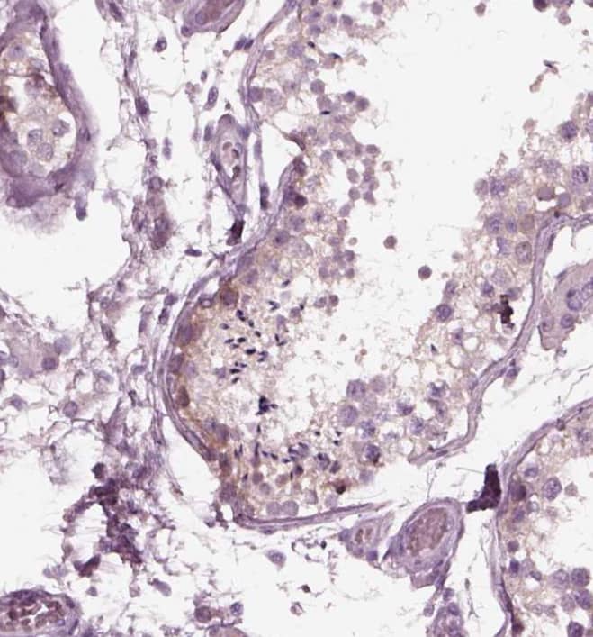 mGluR6 Antibody - BSA Free