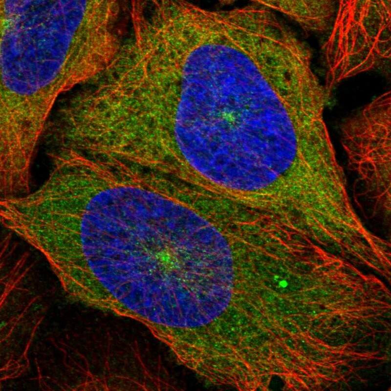 Kinesin 5B Antibody - BSA Free Immunocytochemistry/ Immunofluorescence: Kinesin 5B Antibody [NBP2-58450]