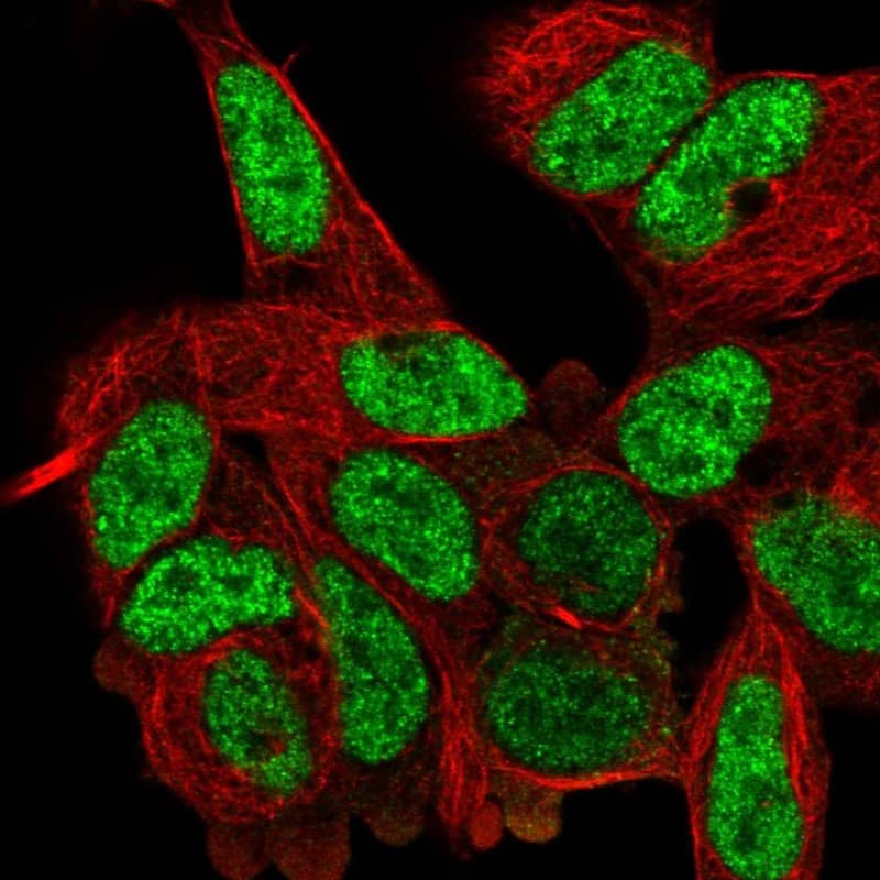 Dishevelled-2 Antibody - BSA Free Immunocytochemistry/ Immunofluorescence: Dishevelled-2 Antibody [NBP2-58480]