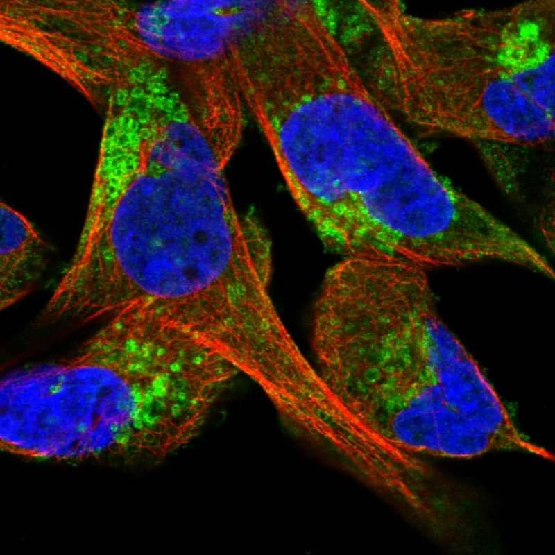 CLCN5 Antibody - BSA Free Immunocytochemistry/ Immunofluorescence: CLCN5 Antibody [NBP2-58621]