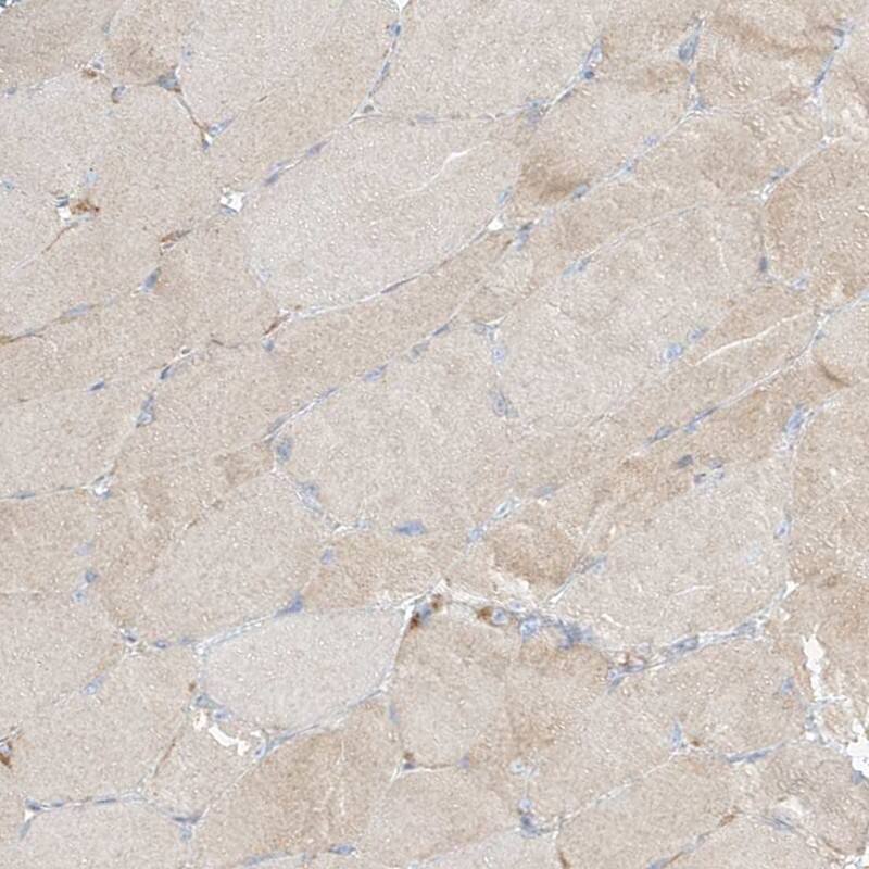 PGD Antibody - BSA Free Immunohistochemistry-Paraffin: PGD Antibody [NBP2-58686]