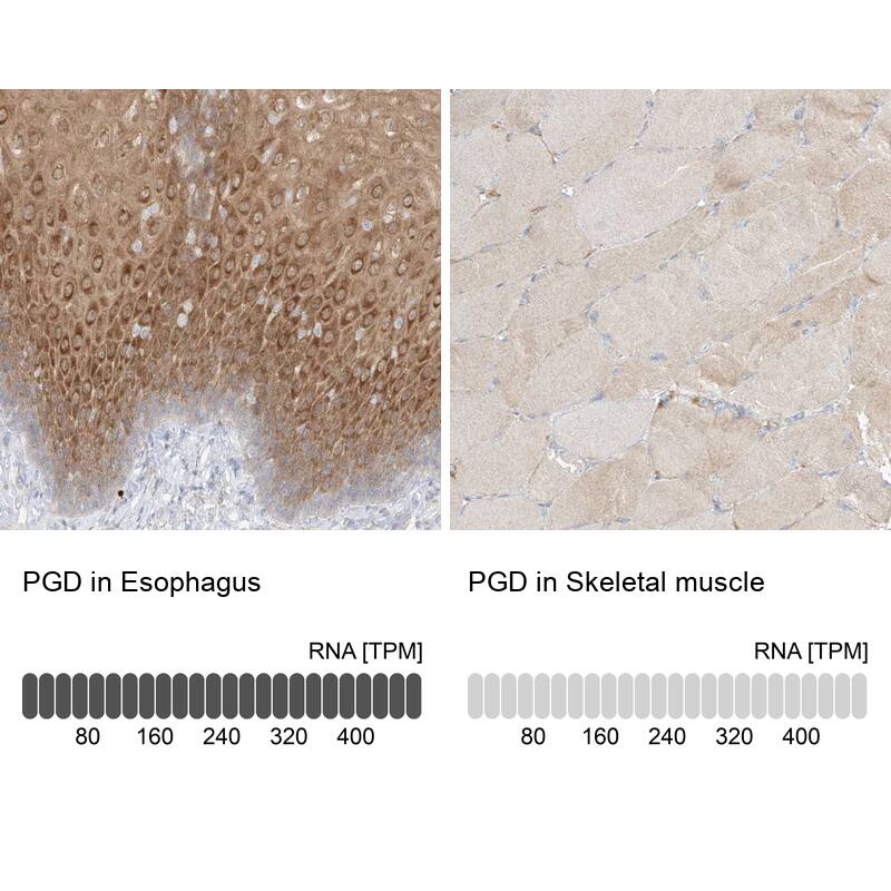 PGD Antibody - BSA Free Immunohistochemistry-Paraffin: PGD Antibody [NBP2-58686]