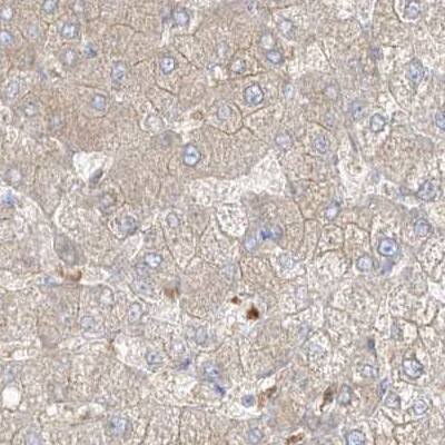 PGD Antibody - BSA Free Immunohistochemistry-Paraffin: PGD Antibody [NBP2-58686]