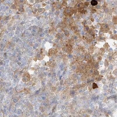 PGD Antibody - BSA Free Immunohistochemistry-Paraffin: PGD Antibody [NBP2-58686]