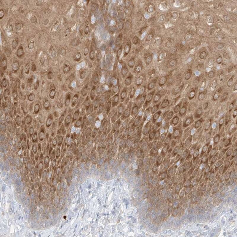 PGD Antibody - BSA Free Immunohistochemistry-Paraffin: PGD Antibody [NBP2-58686]