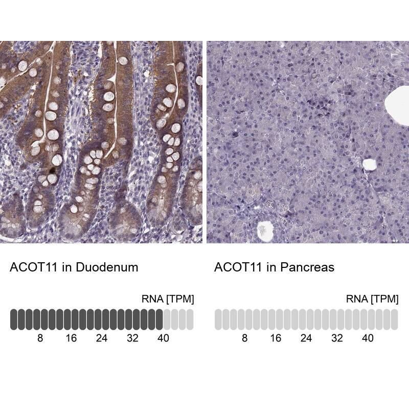 ACOT11 Antibody - BSA Free Immunohistochemistry-Paraffin: ACOT11 Antibody [NBP2-58936]