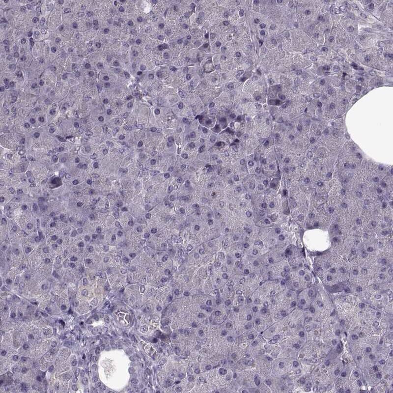 ACOT11 Antibody - BSA Free Immunohistochemistry-Paraffin: ACOT11 Antibody [NBP2-58936]