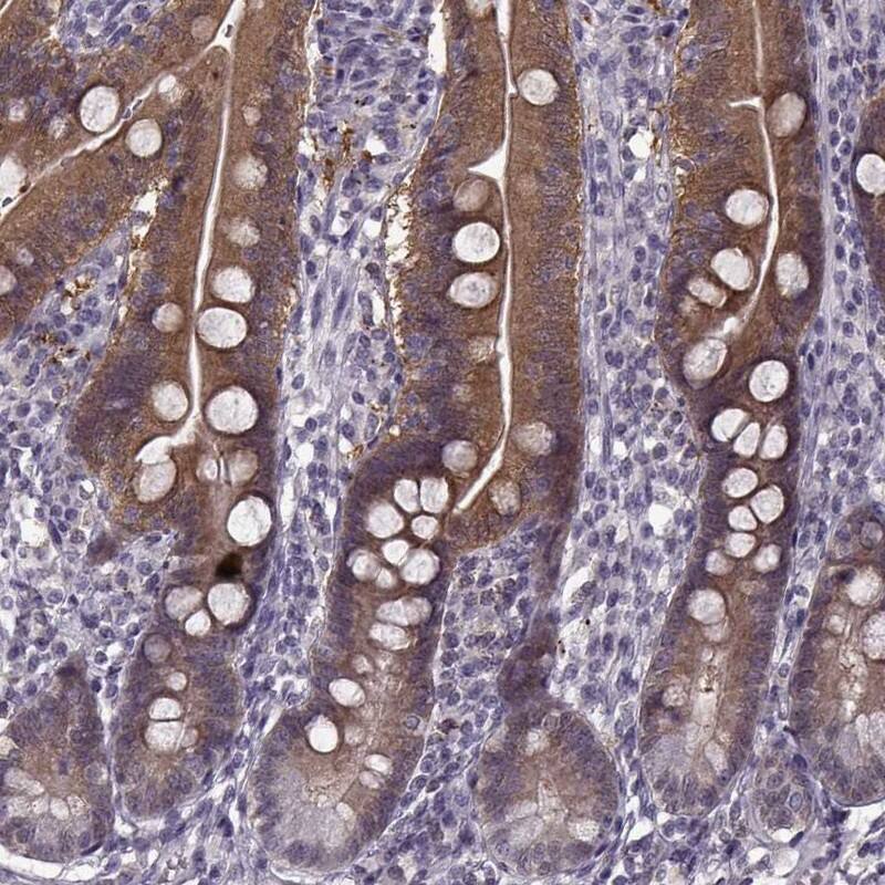 ACOT11 Antibody - BSA Free Immunohistochemistry-Paraffin: ACOT11 Antibody [NBP2-58936]