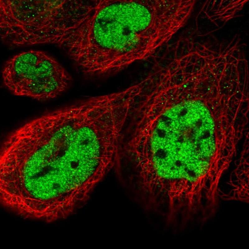 CCNDBP1 Antibody - BSA Free Immunocytochemistry/ Immunofluorescence: CCNDBP1 Antibody [NBP2-58940]