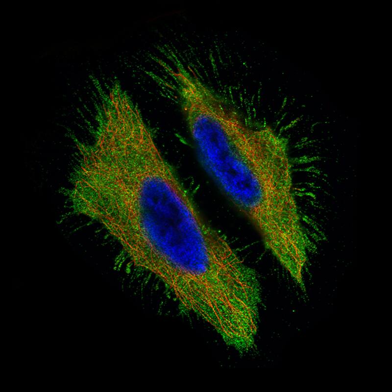 CA125/MUC16 Antibody (CL2782) - BSA Free Immunocytochemistry/ Immunofluorescence: CA125/MUC16 Antibody (CL2782) [NBP2-59023] -