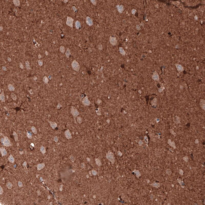 GAPDH Antibody (CL3265) - BSA Free Immunohistochemistry: GAPDH Antibody (CL3265) [NBP3-52489]