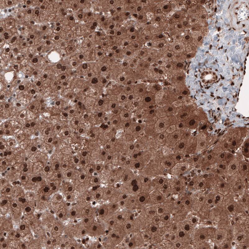 GAPDH Antibody (CL3265) - BSA Free Immunohistochemistry: GAPDH Antibody (CL3265) [NBP3-52489]