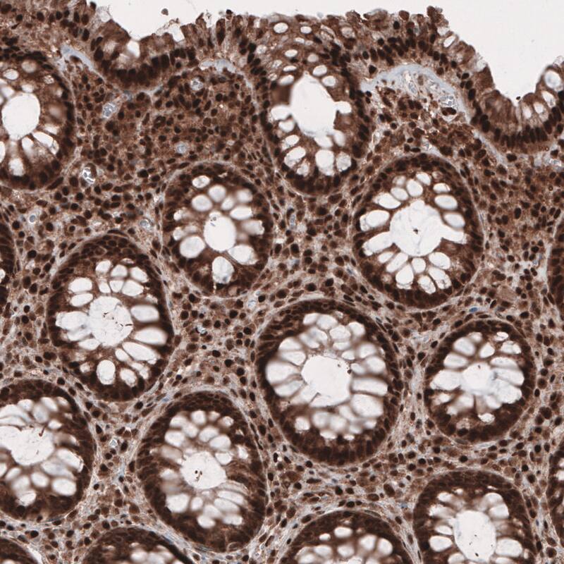 GAPDH Antibody (CL3265) - BSA Free Immunohistochemistry: GAPDH Antibody (CL3265) [NBP3-52489]