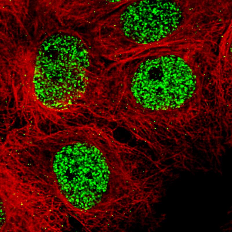SMCHD1 Antibody (CL4265) - BSA Free Immunocytochemistry/ Immunofluorescence: SMCHD1 Antibody (CL4265) [NBP2-59045]