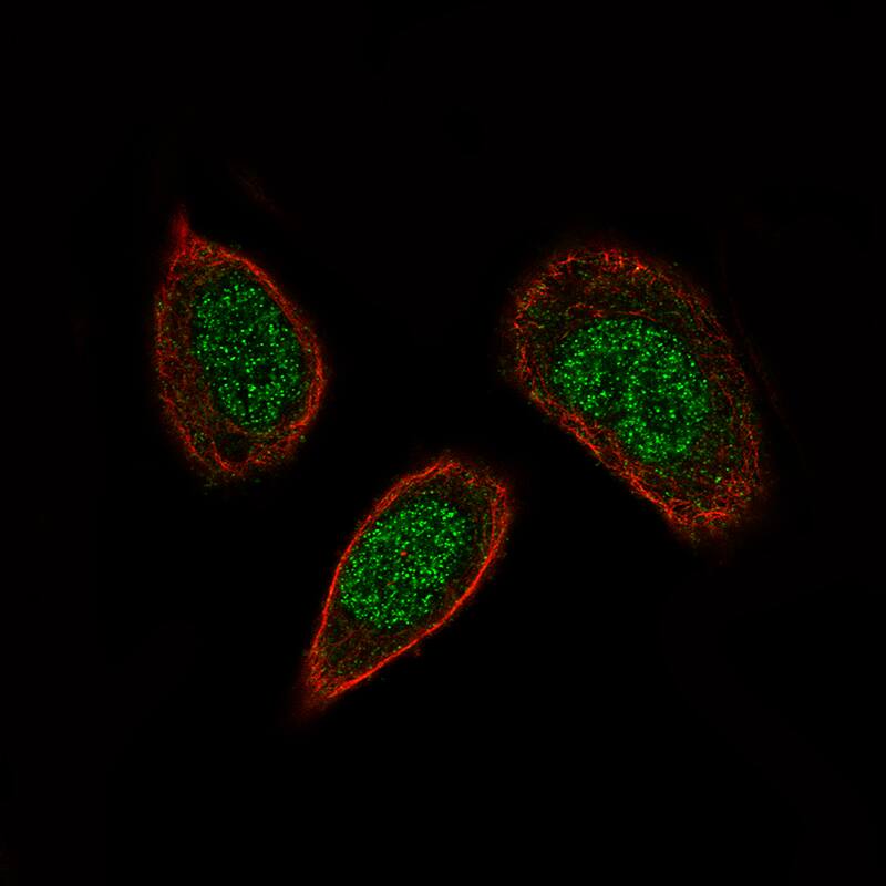 SOX21 Antibody (CL4688) - BSA Free Immunocytochemistry/ Immunofluorescence: SOX21 Antibody (CL4688) [NBP2-59059]
