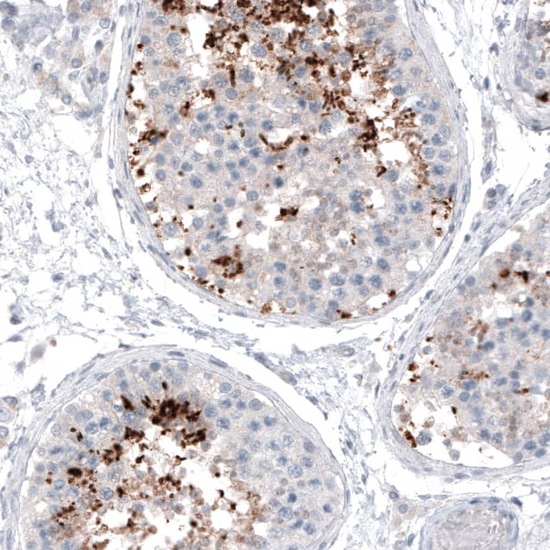CT83 Antibody (CL4762) - BSA Free Immunohistochemistry-Paraffin: CT83 Antibody (CL4762) [NBP2-59062]