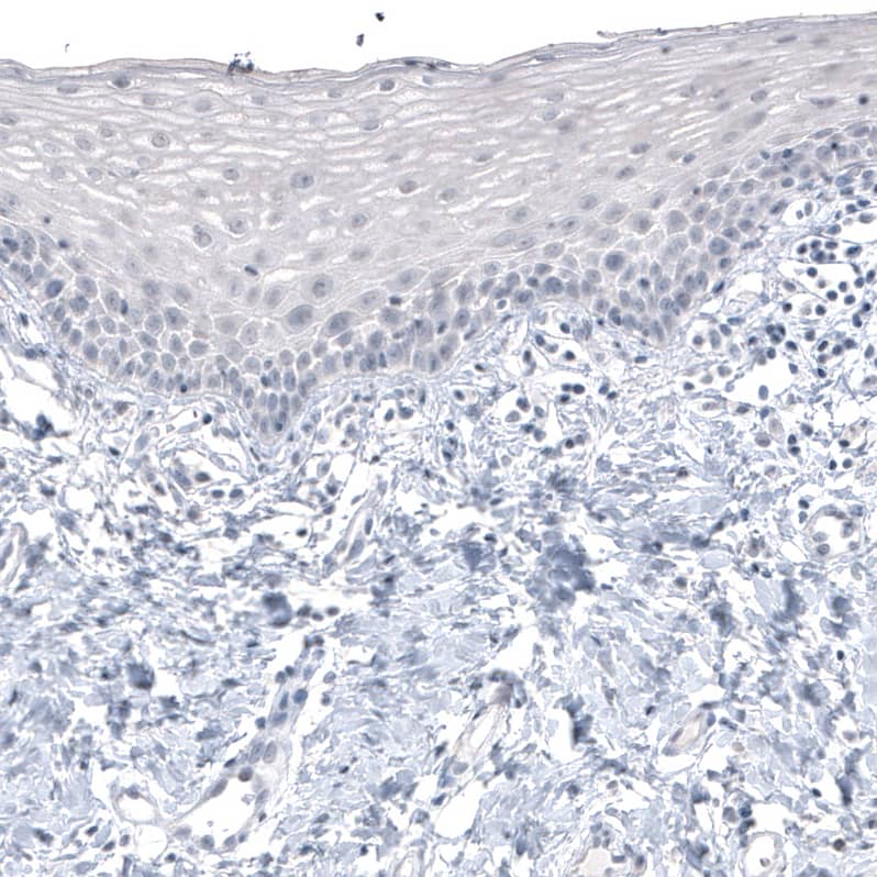 CT83 Antibody (CL4762) - BSA Free Immunohistochemistry-Paraffin: CT83 Antibody (CL4762) [NBP2-59062]