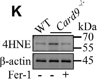 4-Hydroxynonenal Antibody (12F7) - BSA Free