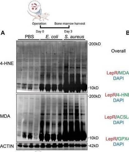Malondialdehyde Antibody (11E3) - BSA Free