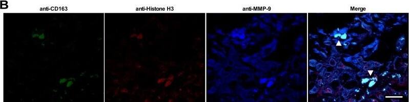 MMP-9 Antibody (S51-82) - BSA Free